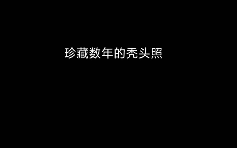 秃头怪四个半月非那雄安治疗图片纯享版哔哩哔哩bilibili