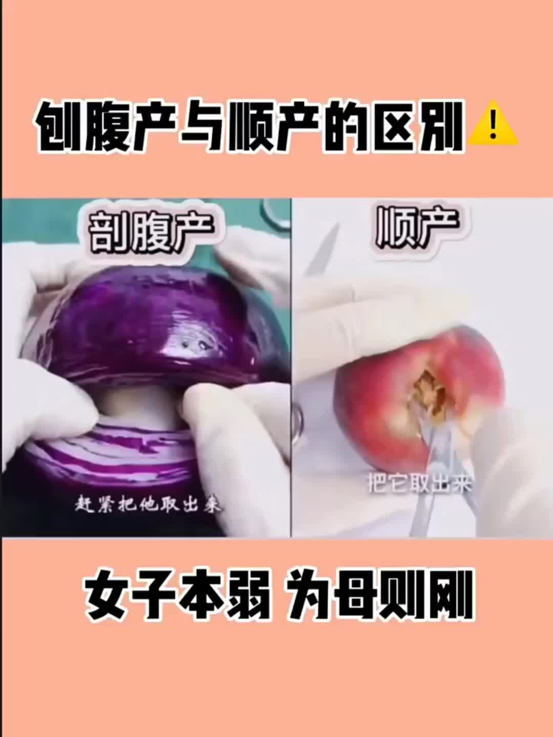 剖腹产与顺产的区别哔哩哔哩bilibili