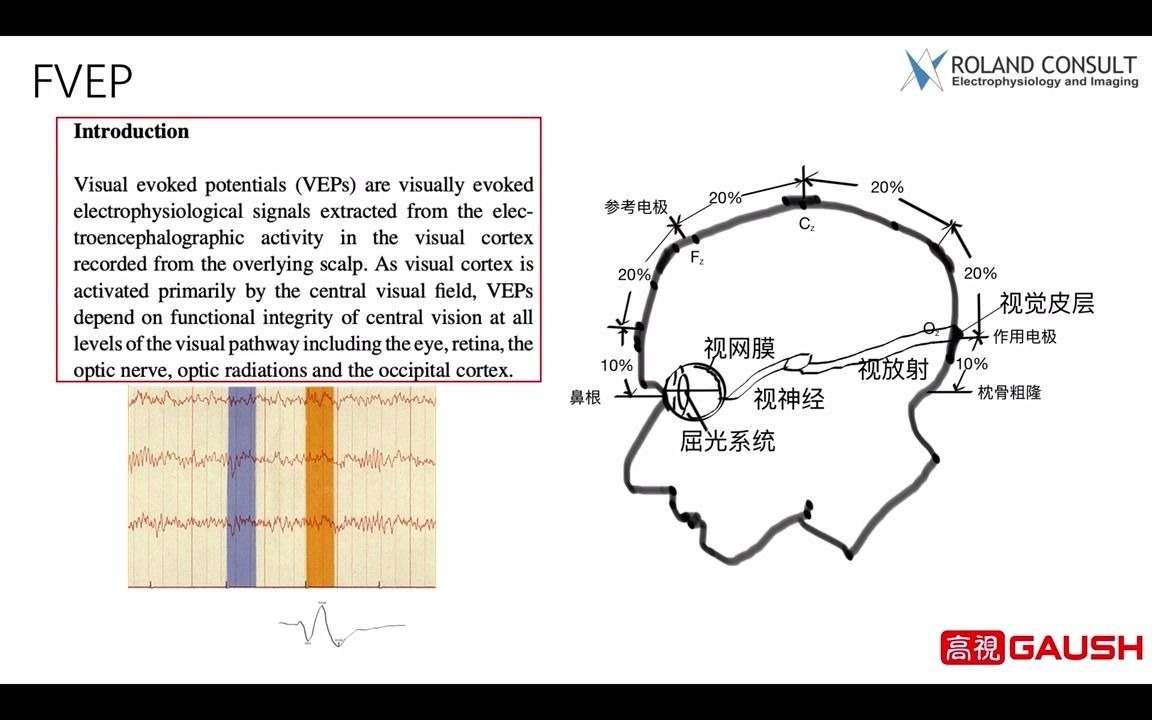 【眼科】高视罗兰电生理FVEP操作步骤哔哩哔哩bilibili