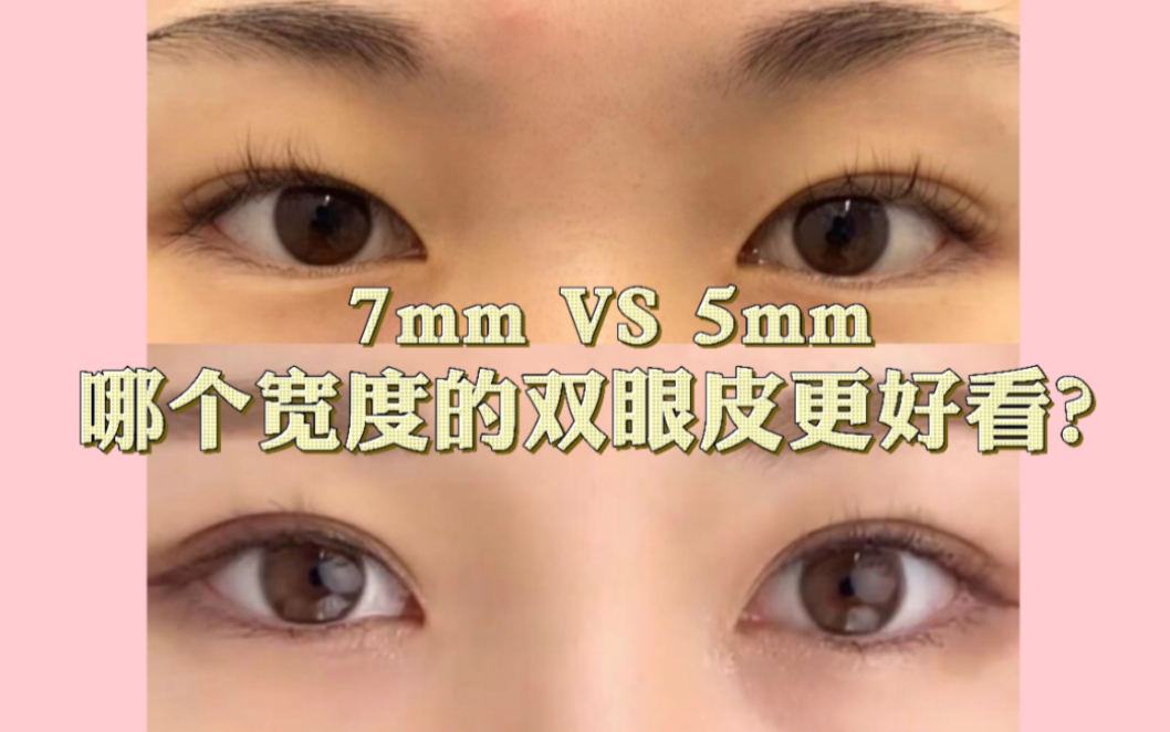 7mm跟5mm,哪个宽度的双眼皮更好看?哔哩哔哩bilibili