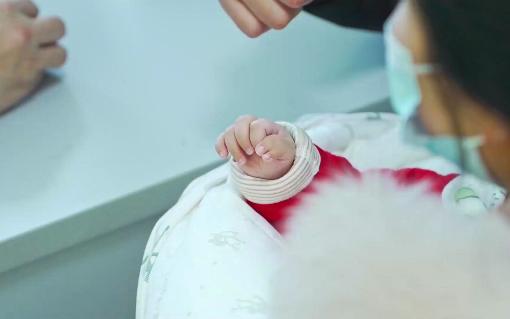 2个半月宝宝右手拇指多指,平时抓东西不得力,急坏了爸爸妈妈!