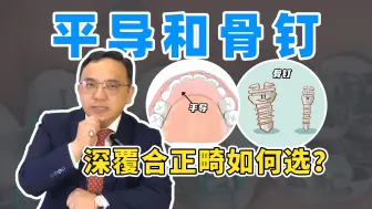 Download Video: 深覆合矫正效果大公开，平导和骨钉哪个更厉害？