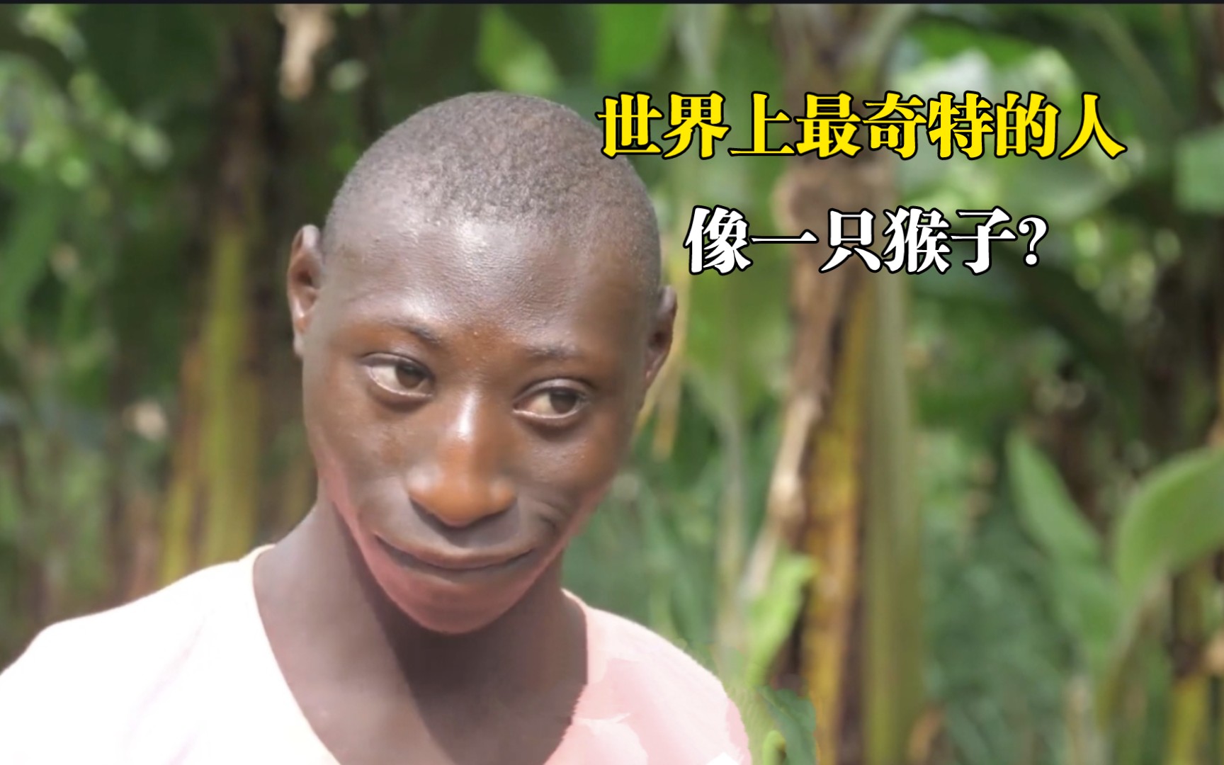 世界上长相最奇特的人,像一只猴子?