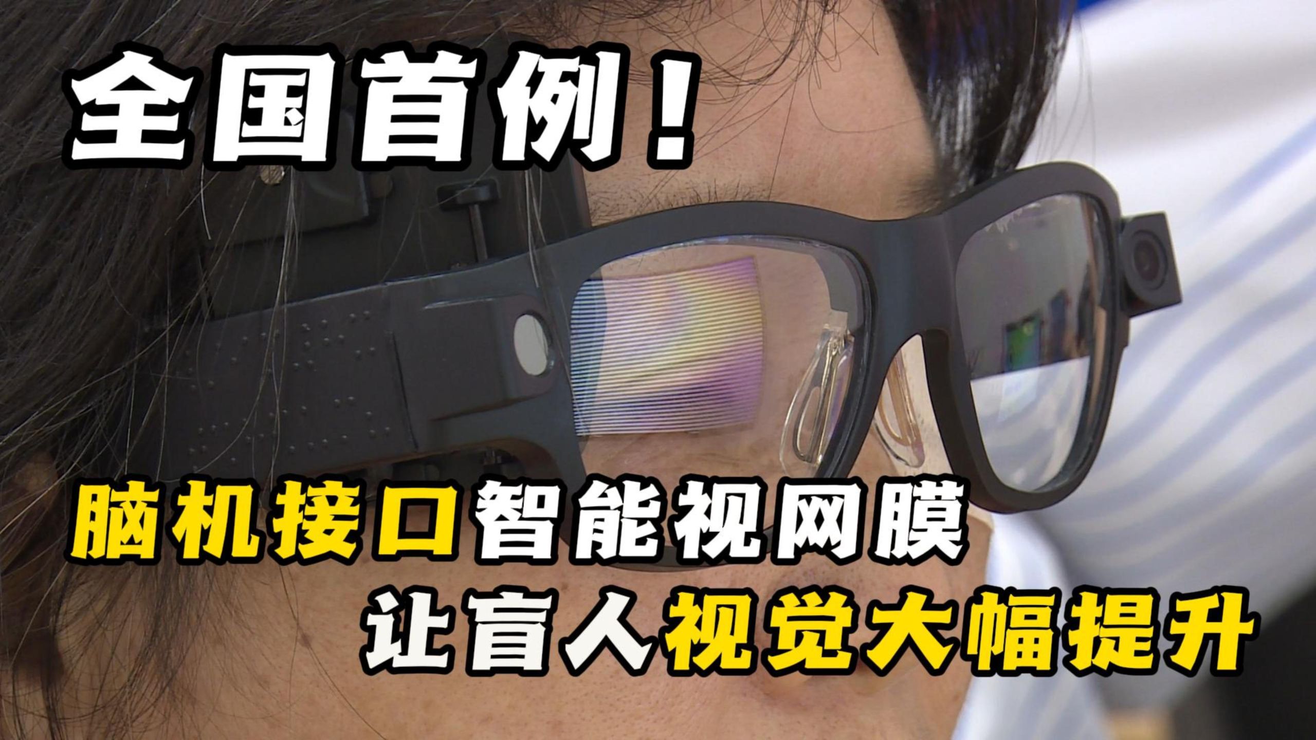 全国首例！脑机接口智能视网膜让盲人视觉大幅提升