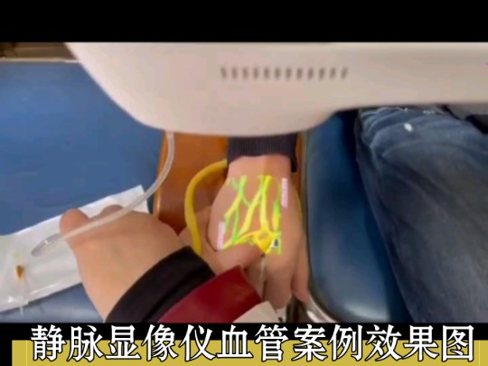三色医用静脉血管显像仪输液透视仪扎针神器红外线高清护士血管查找仪