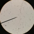 【微生物】腐霉的菌丝和游动孢子