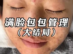 Download Video: 困扰了十年的包包肌，四个月后大结局了！一起来看看这个变化