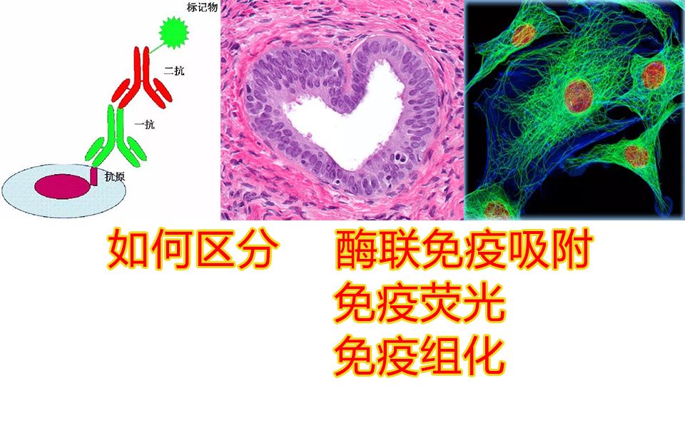 【实验】如何区分酶联免疫吸附ELISA,免疫荧光,免疫组化(免疫组织化学)原理哔哩哔哩bilibili