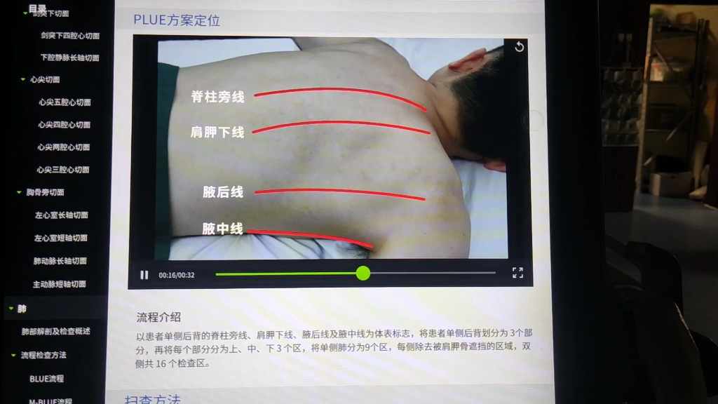 肺部超声哔哩哔哩bilibili