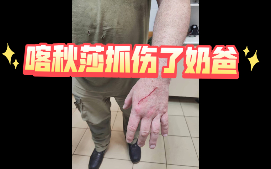 喀秋莎抓伤了奶爸，小心！很多人问我们为什么不抱抱喀秋莎，因为这对于喀秋莎来说可能只是玩耍，但是对饲养员来说却很危险
