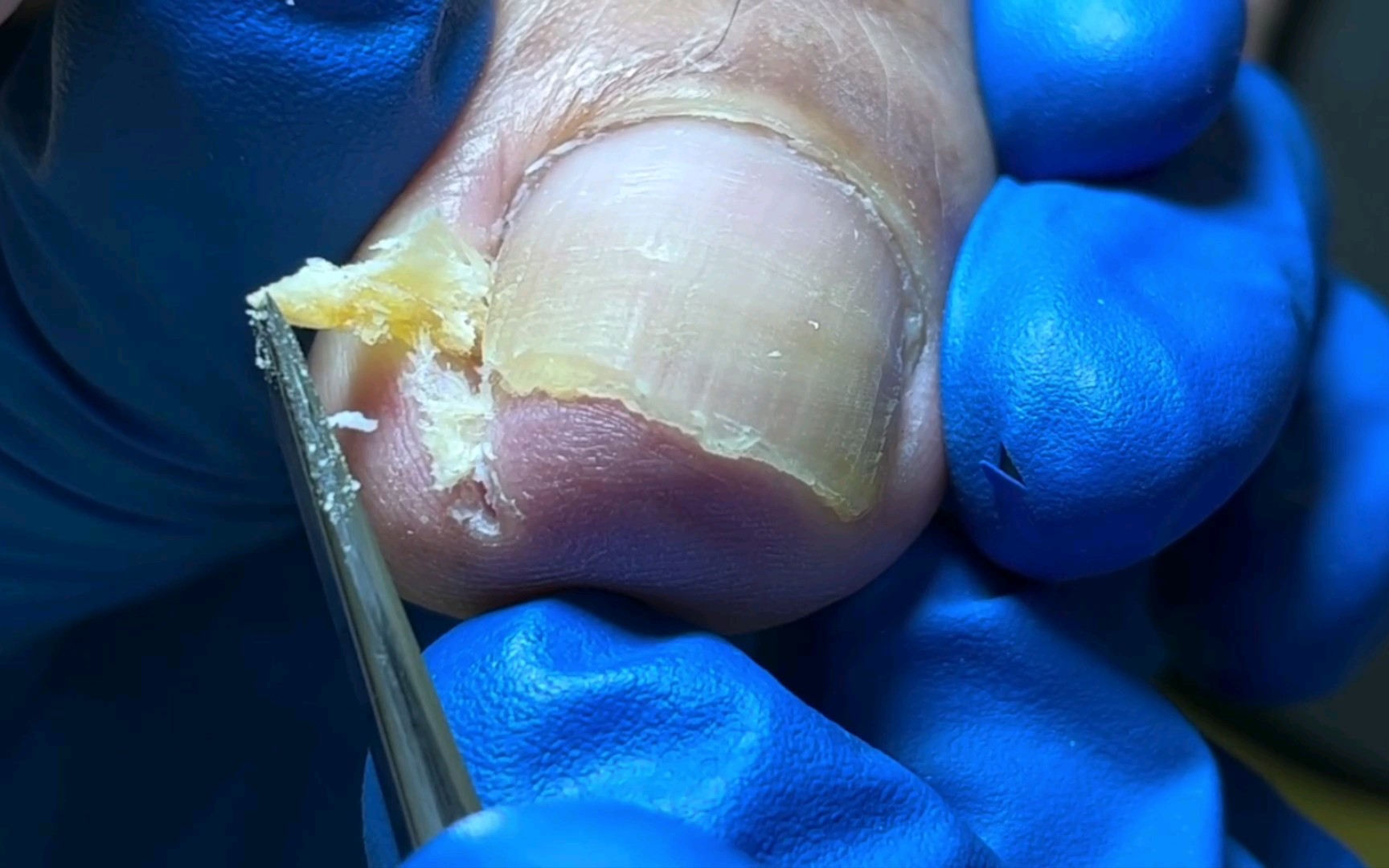 里边藏那么多 你脚不疼谁脚疼