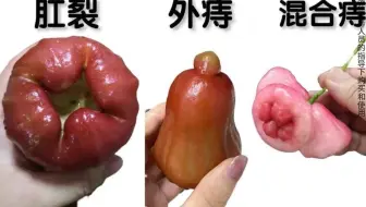 拉屎爱玩手机的建议进来看看！