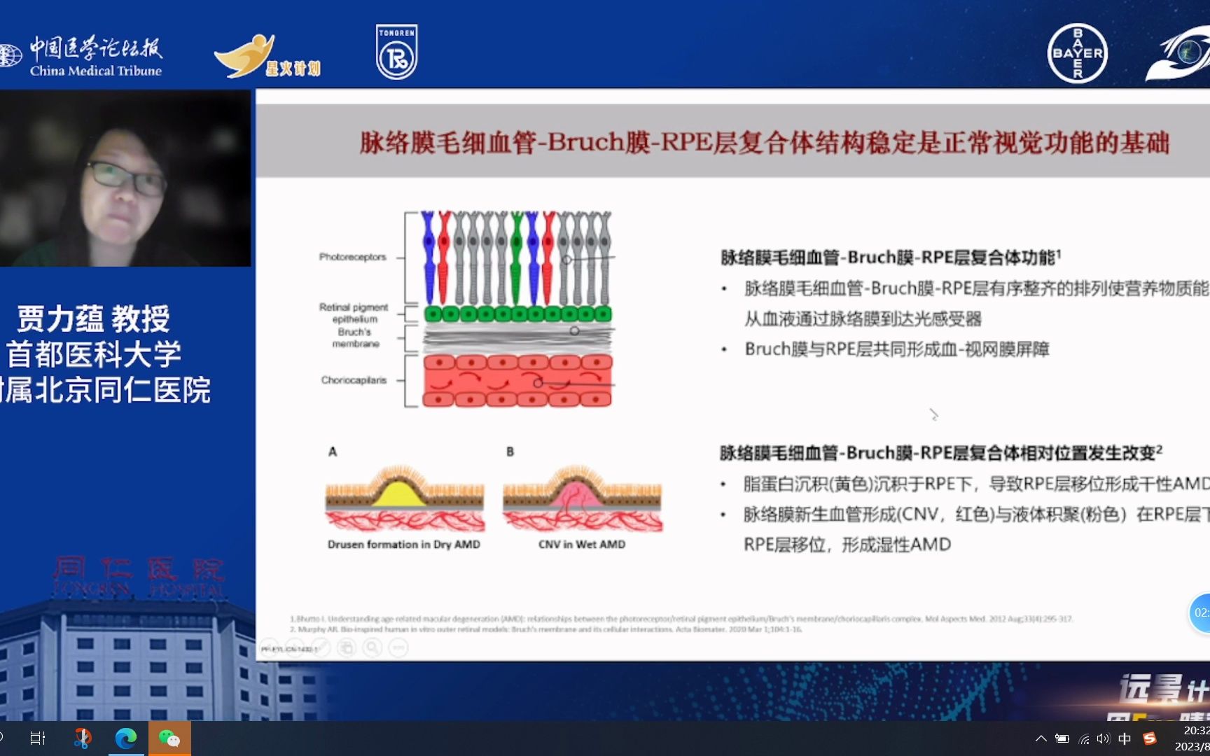 不同类型PED的影像学特点及治疗哔哩哔哩bilibili