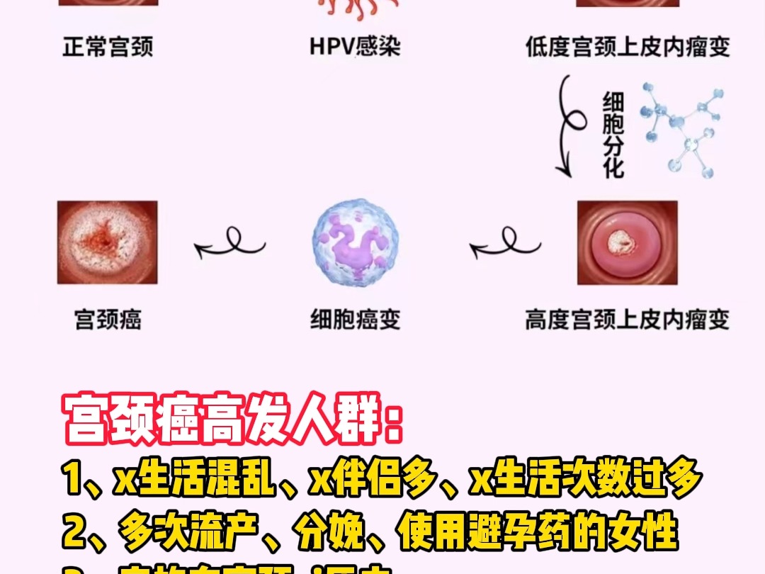 HPV是怎么感染的图片