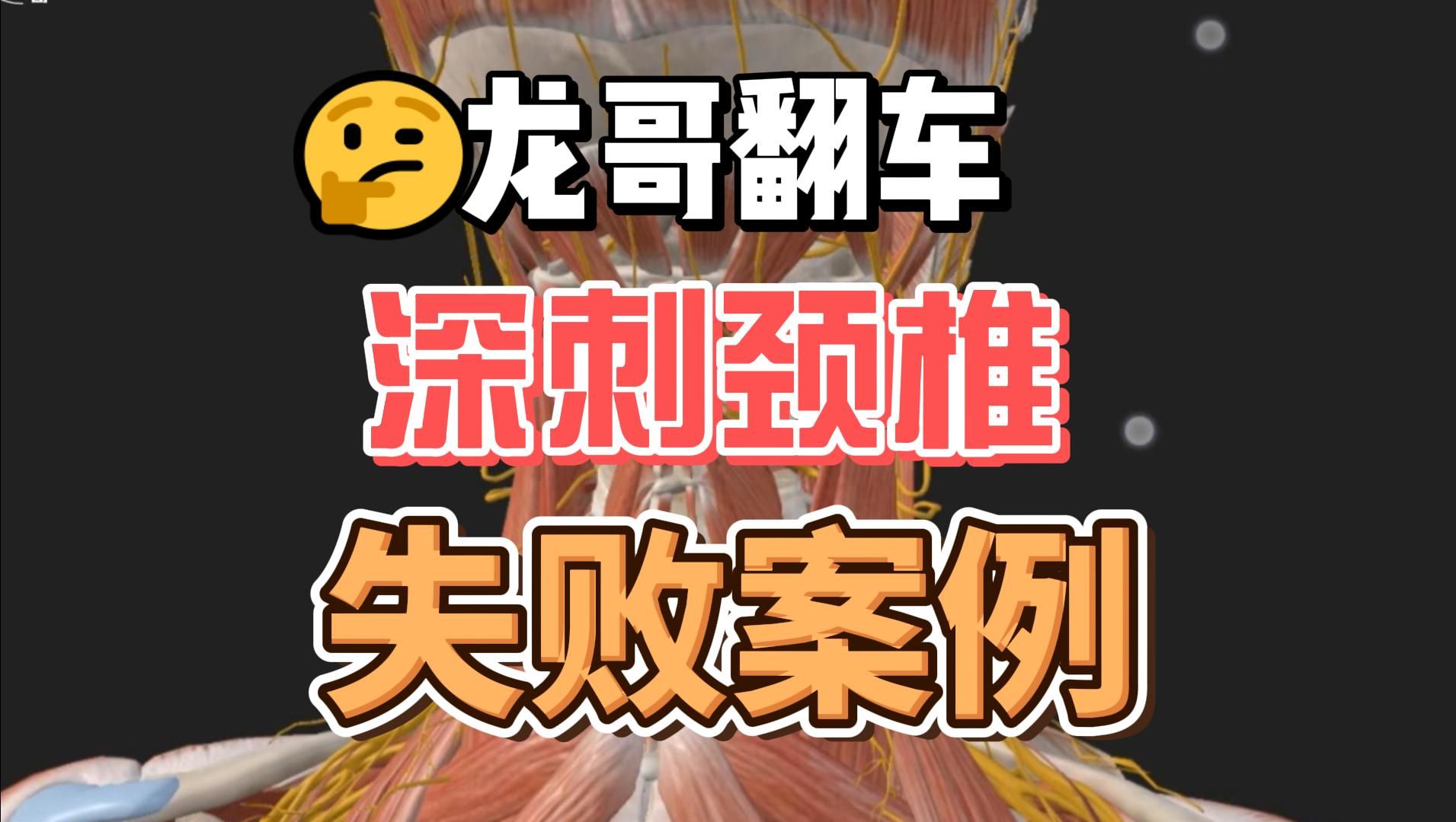 龙哥又翻车了,深刺颈椎出事了,失败的案例更能提高技能哔哩哔哩bilibili