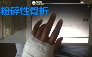 手残 指右手骨折 搜索结果 哔哩哔哩 Bilibili