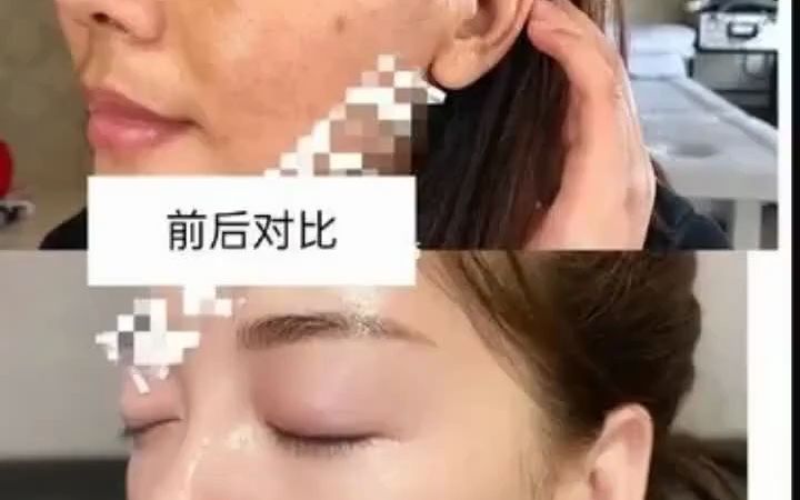 去斑点的方法,每天洗完脸后使用让你素颜出门哔哩哔哩bilibili