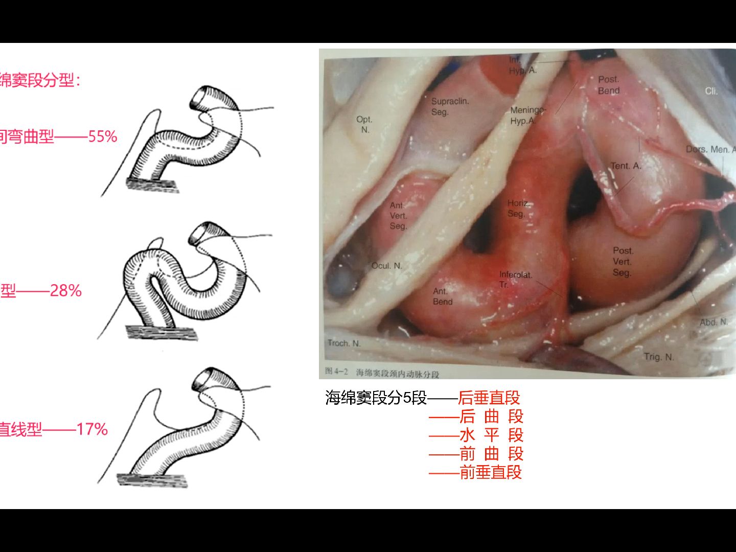 海绵窦腔哔哩哔哩bilibili