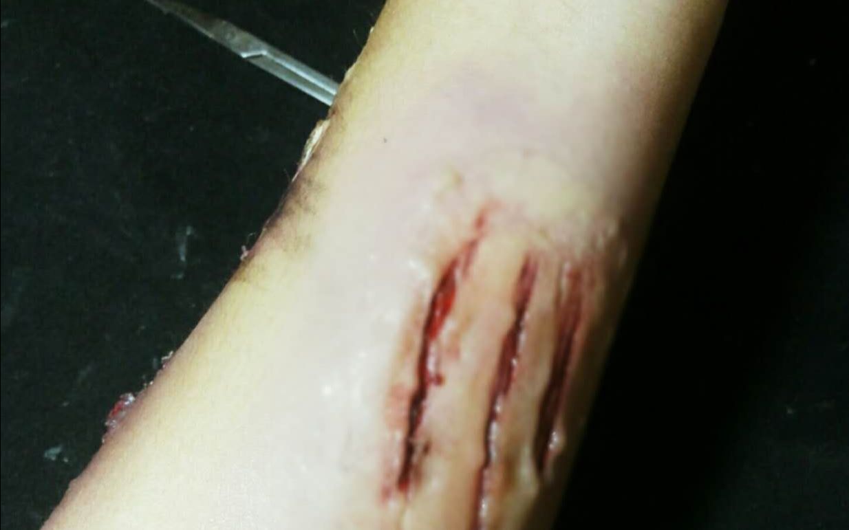 特效化妆教程三种方法化抓伤手臂受伤妆简单易学上手max慎入