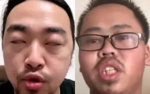 下载视频: 峰哥实锤小张是铁处男。