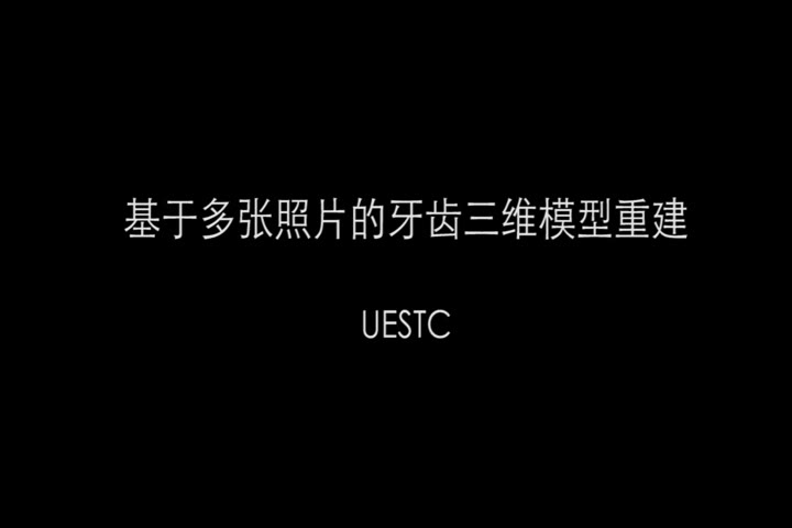 基于多张照片的牙齿三维模型重建哔哩哔哩bilibili