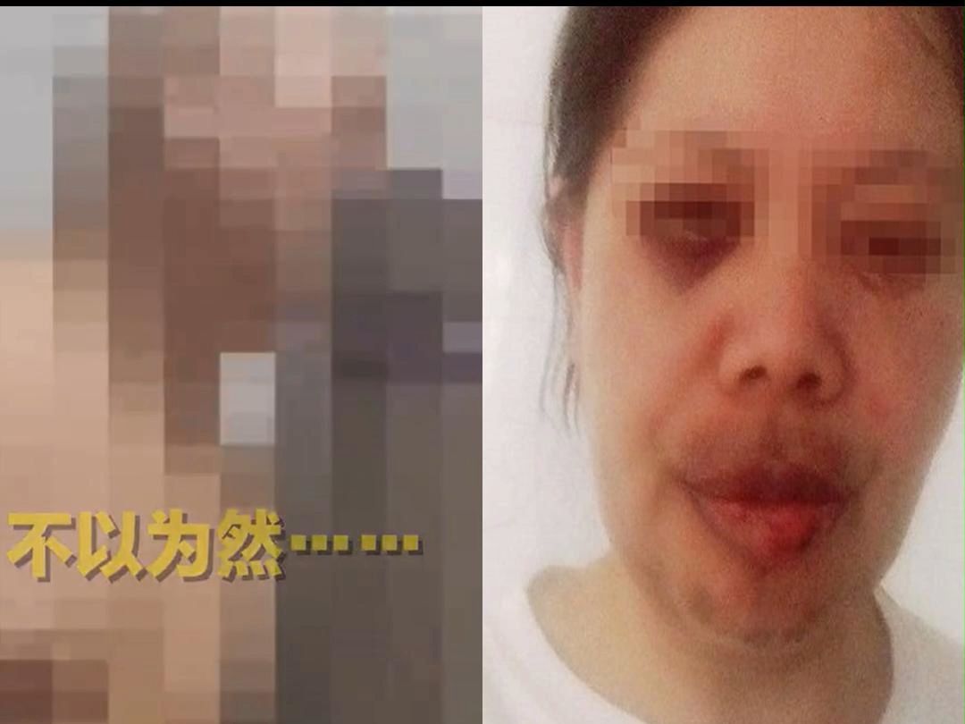 一生都在被家暴母亲发声:被丈夫扇近7小时巴掌,丈夫坐牢出狱后仍威胁妻子哔哩哔哩bilibili