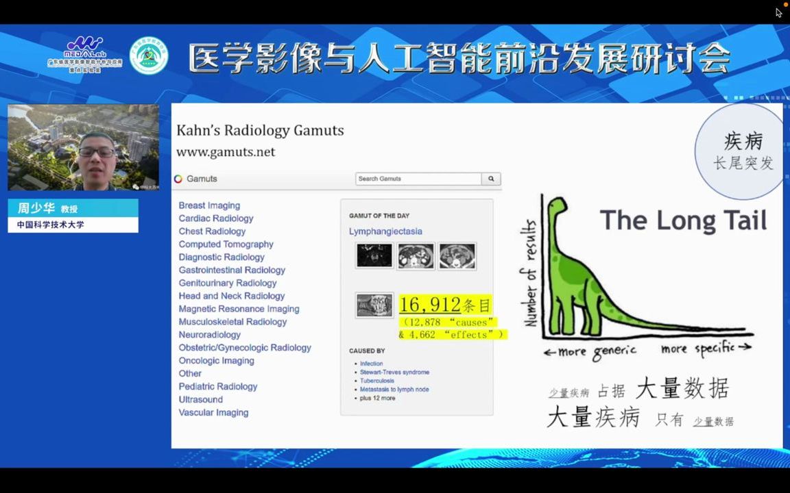 医学影像+人工智能的特点、技术与趋势周少华哔哩哔哩bilibili