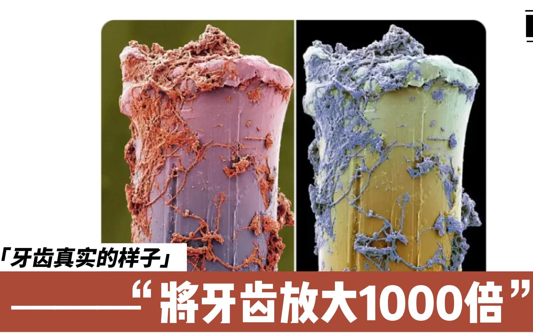 牙齿放大一千倍的真实样子您知道吗?