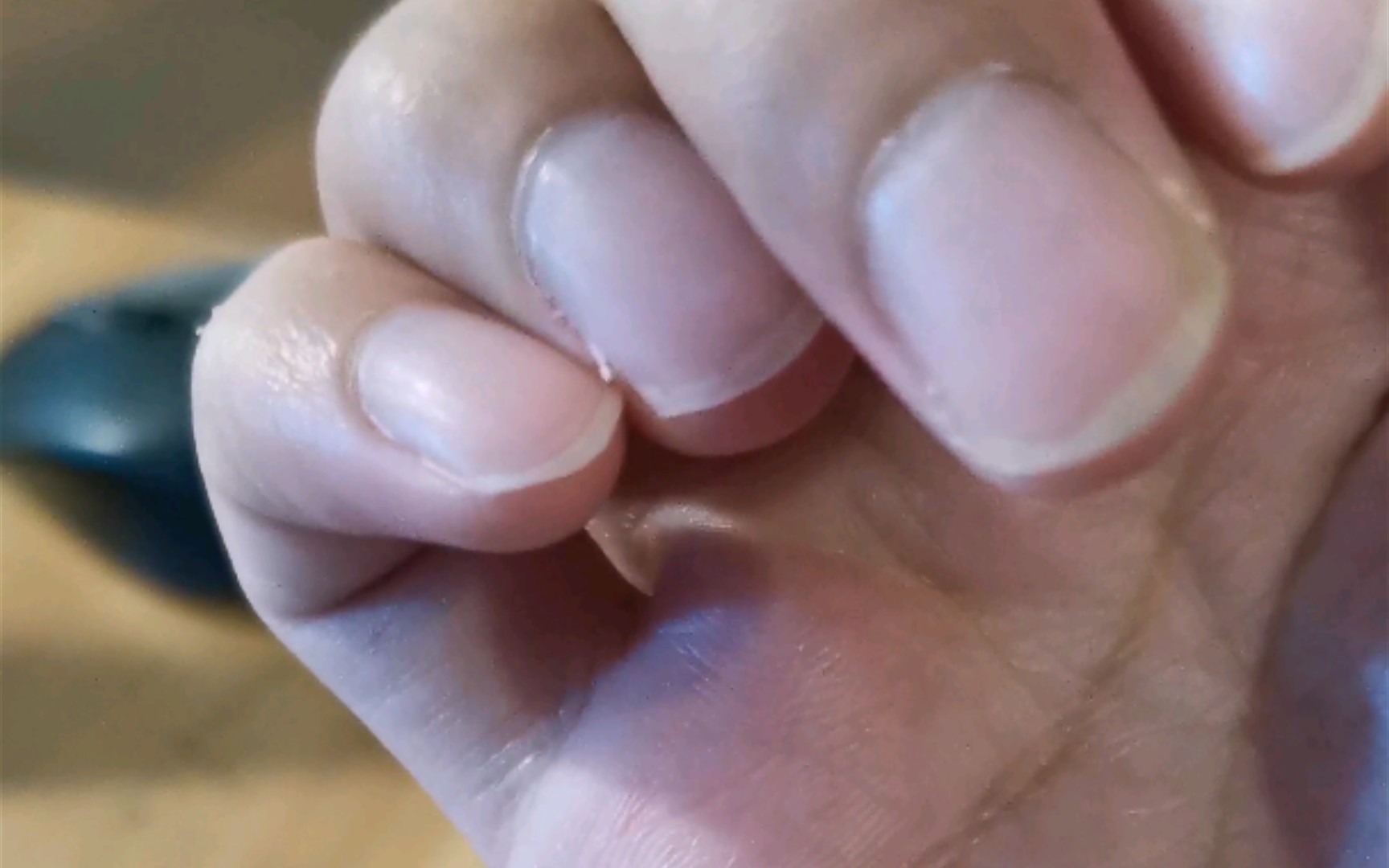 巨长的倒刺撕下来