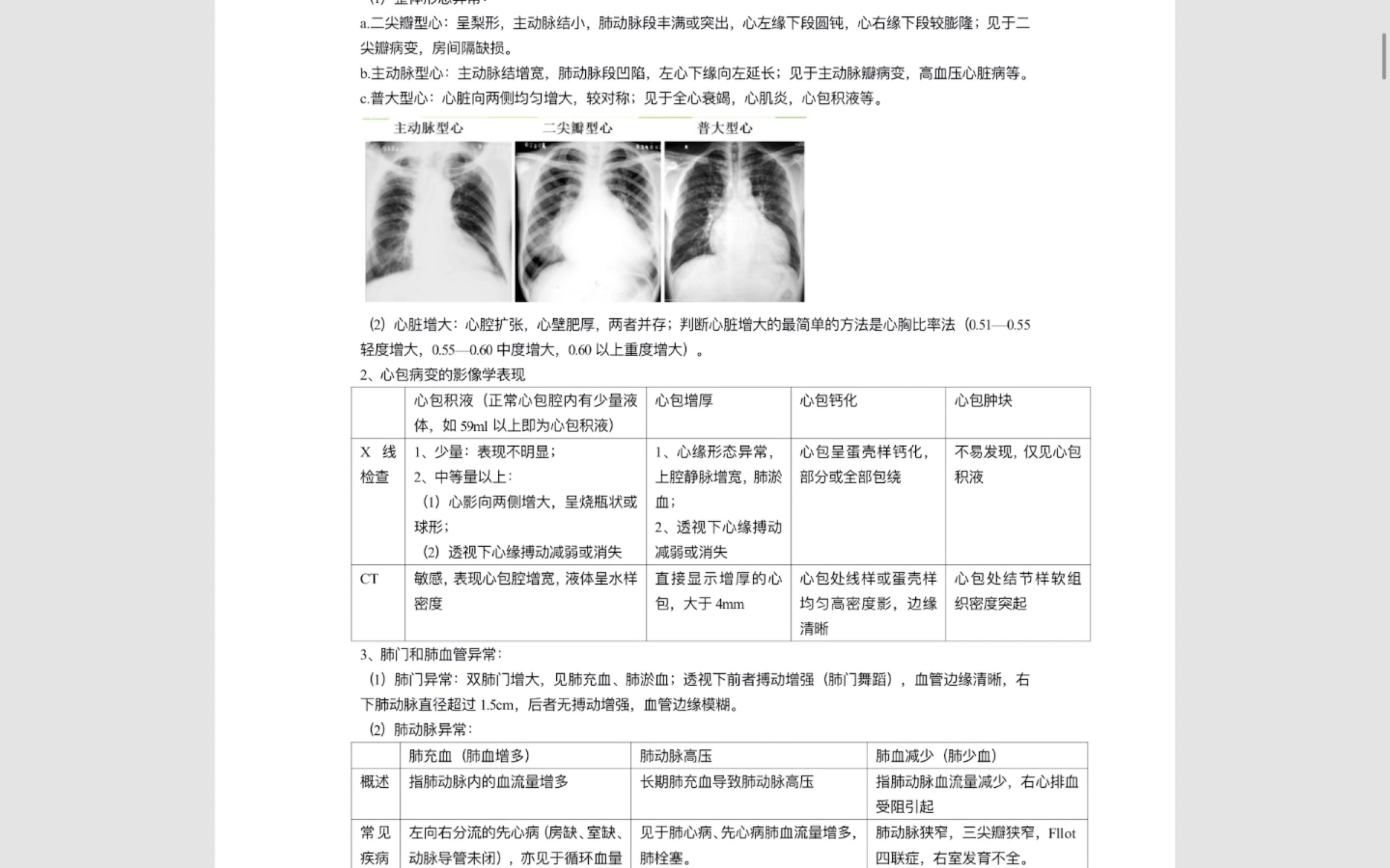 医学影像学笔记(表格对比)哔哩哔哩bilibili