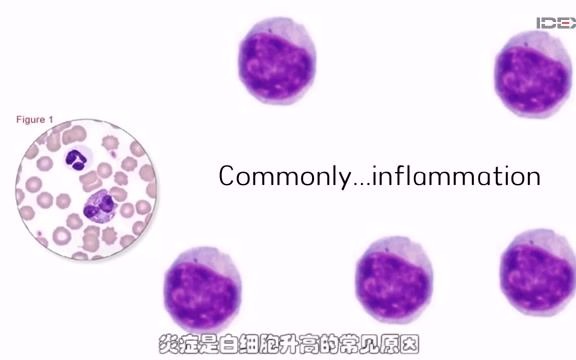 [图]White Blood Cells Category Detail白细胞分类细节