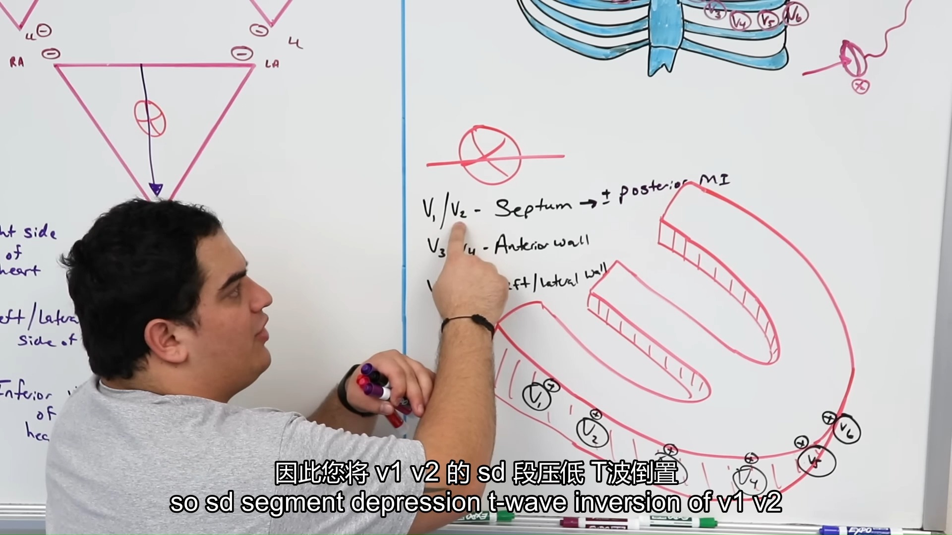ninja nerd心电图基础课-胸导联v1-v6