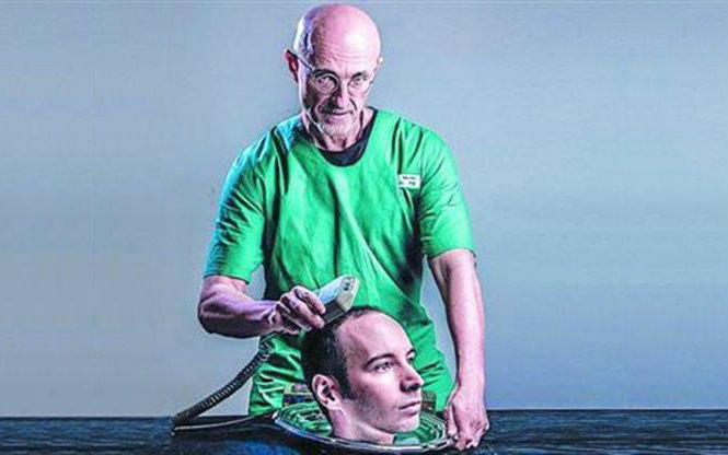 全球首例换头手术耗资上亿,预计2017年实施,你准备好了吗?