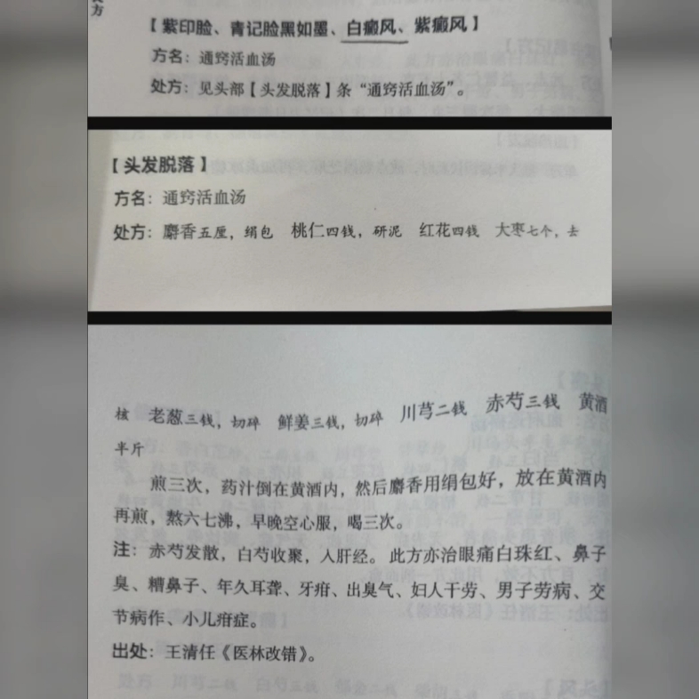 [图]分享一些张至顺道长治疗白癜风的方剂，选自《米晶子济世良方》