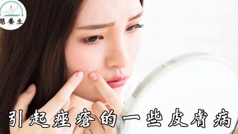 一钻进被子就全身发痒 那是螨虫正在你身上乱爬 不用洗 不用晒只要在床上放点这个 就能轻鬆杀死所有螨虫 哔哩哔哩