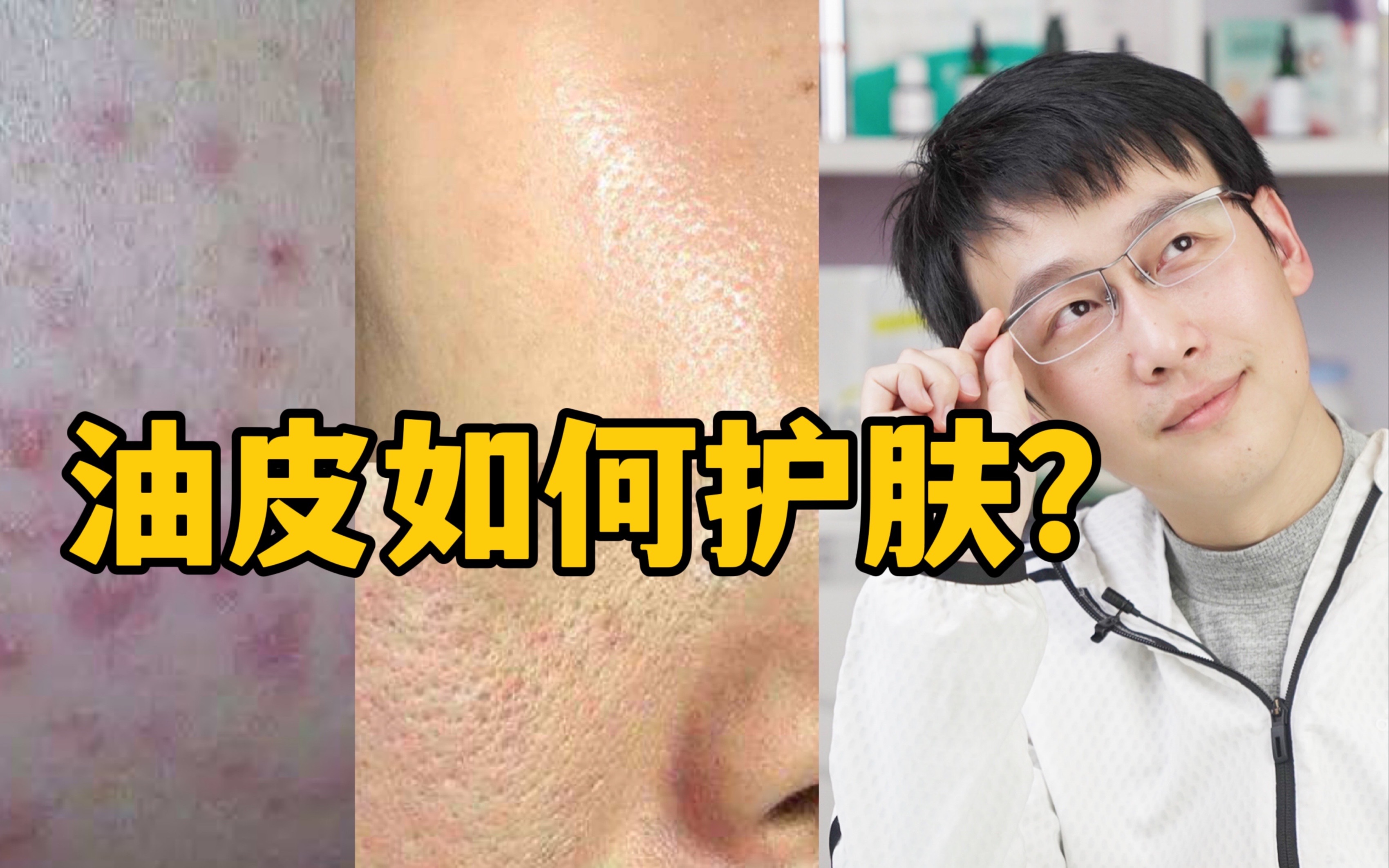 护肤科学家|油从哪里来?四个重点教你油皮如何正确护肤!哔哩哔哩bilibili