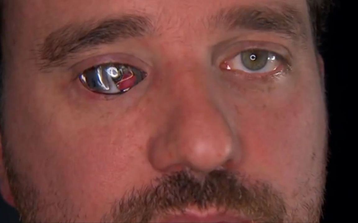 43岁失明男子右眼装入摄像机拍出30分钟纪录片