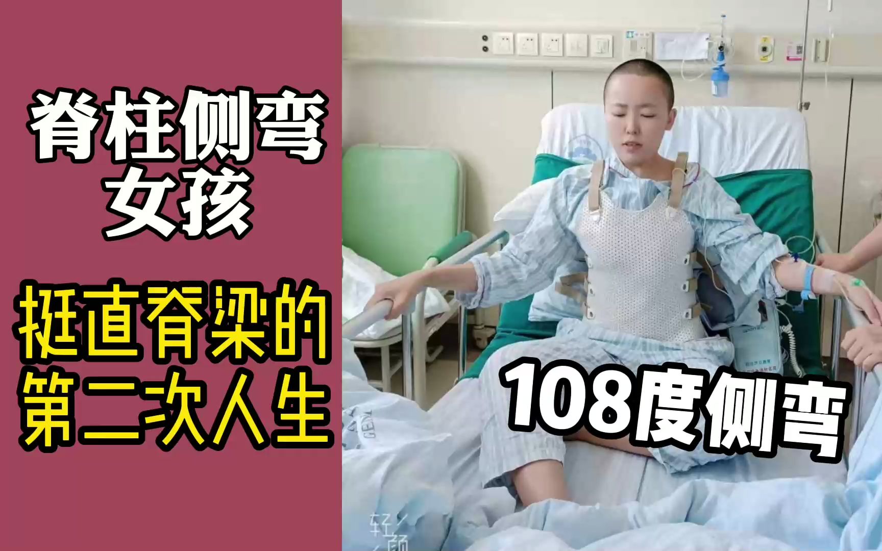 脊柱侧弯女孩挺直脊梁的第二次人生【陶惠人教授手术案例】哔哩哔哩bilibili