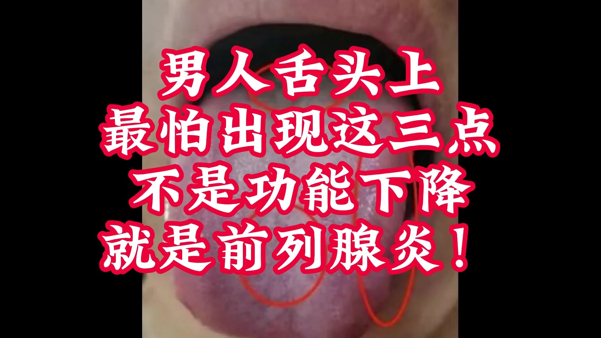 男人舌头上,最怕出现这三点,不是功能下降就是前列腺炎!哔哩哔哩bilibili