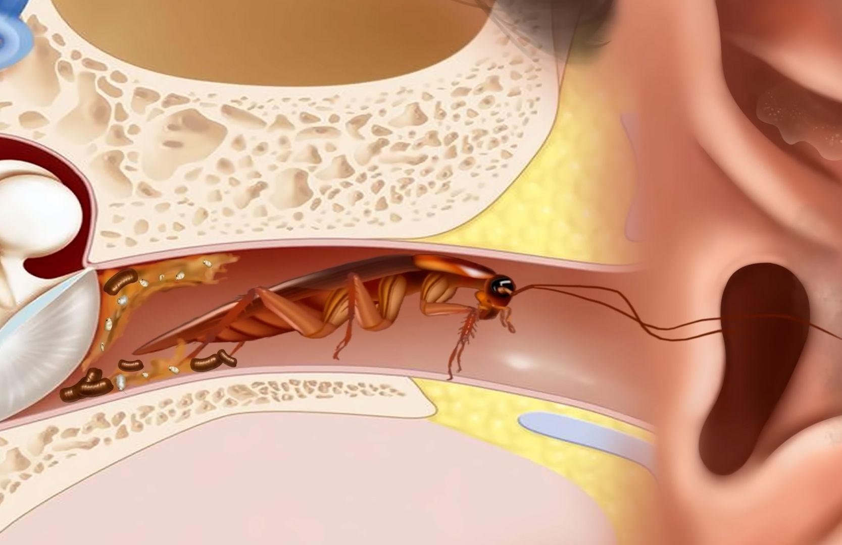 寄生虫钻入耳朵图片