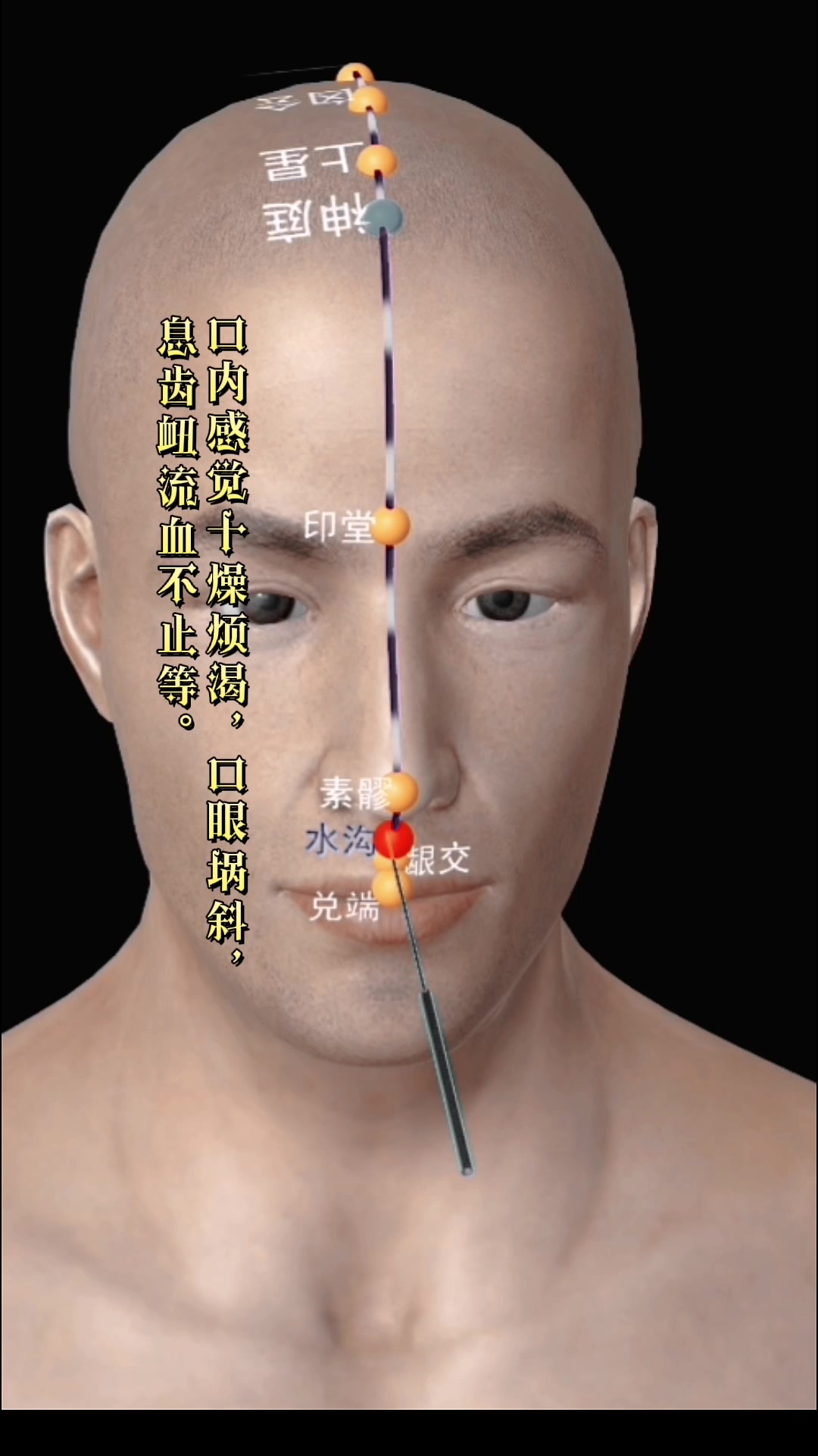 人中穴解穴方法哔哩哔哩bilibili