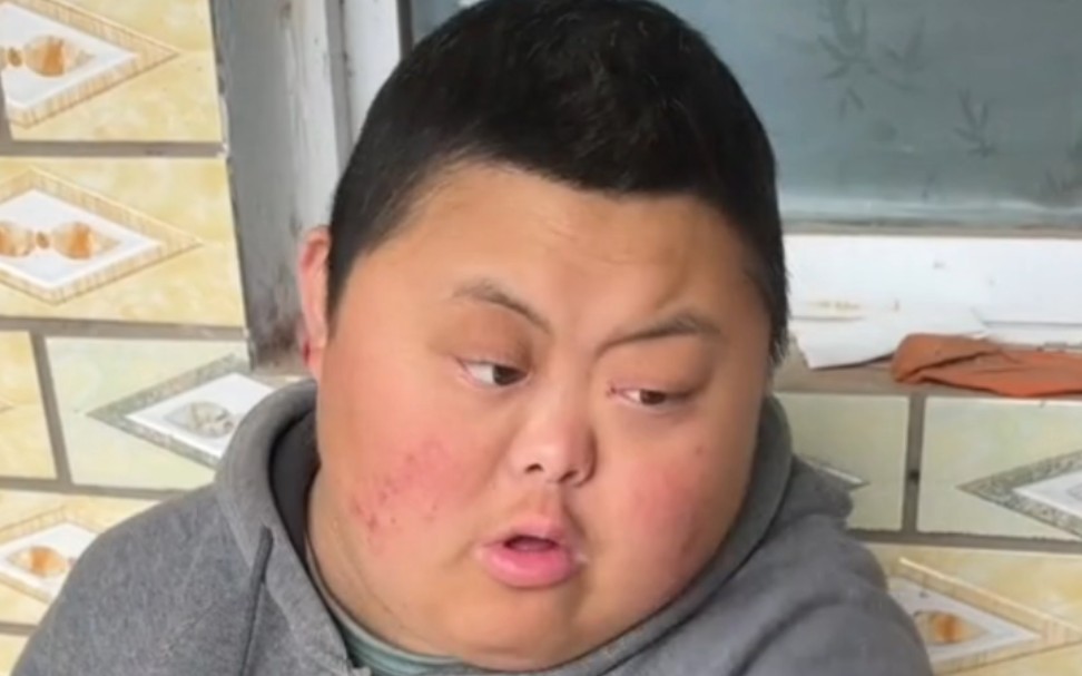 小鸭哥葱头肉气坏了