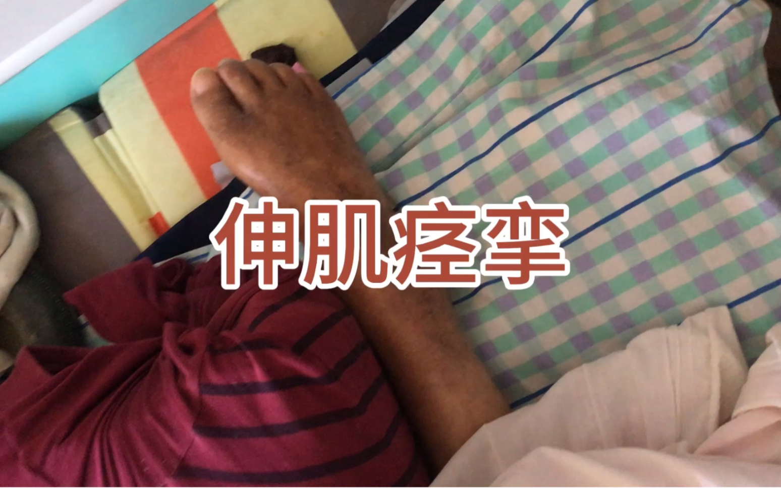 什么是伸肌痉挛哔哩哔哩bilibili