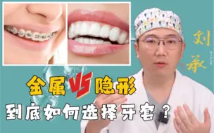 Tải video: 金属牙套PK隐形牙套如何选择？