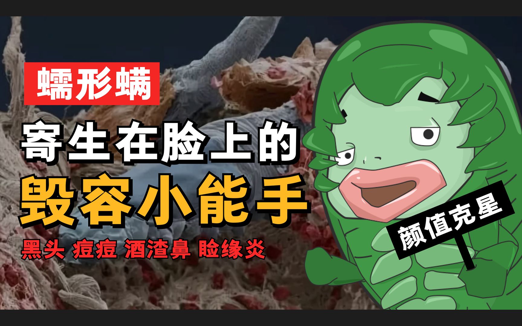 【寄生虫】蠕形螨:我要让所有人知道,你脸上这块油田被我承包了!