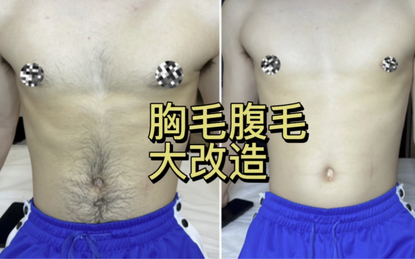 男士脱毛拒绝油腻哔哩哔哩bilibili