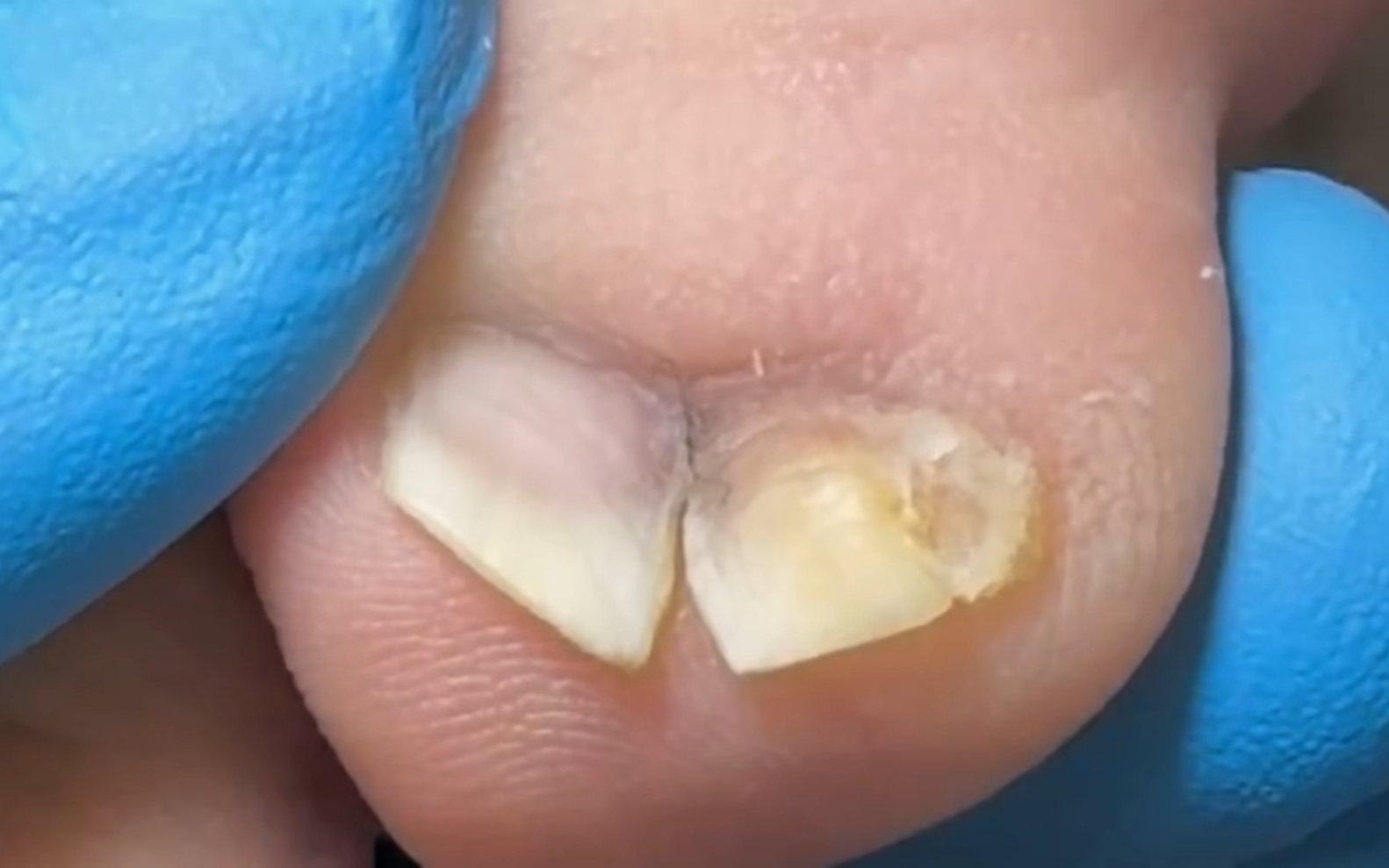 太狠了,这是直接裂开了呀