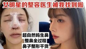 花了35万整容 到底整了哪里 所有项目大公开 8年整容经验分享树立正确审美 一滴咖喱酱 哔哩哔哩 つロ干杯 Bilibili