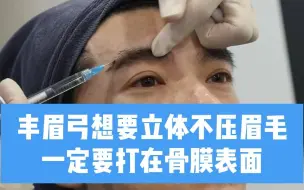 支点提升注射：玻尿酸丰眉弓，如何做到立体，又不压眉毛！