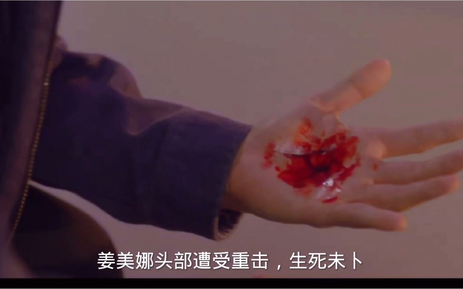 [图]《双面女人》十五集cut（1）女主因打架被警方逮捕，姜美娜头部被砸，生死未卜